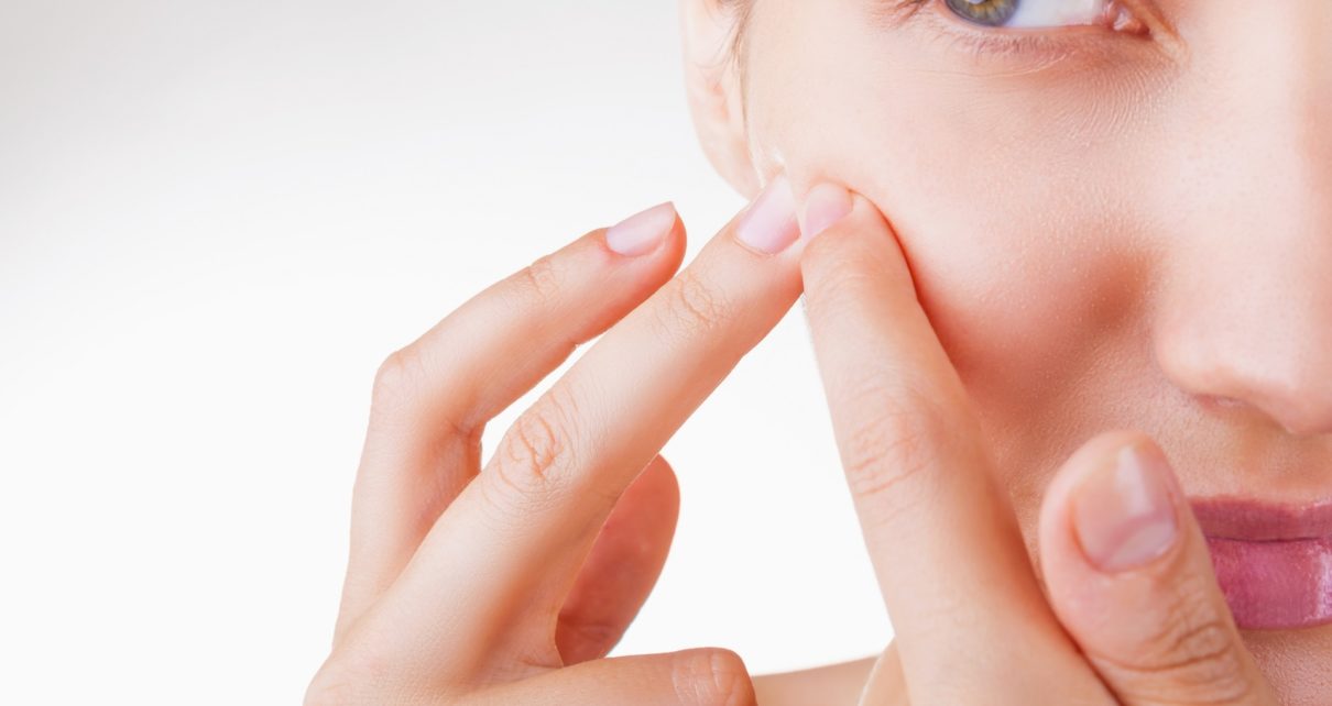 Cara Alami Menghilangkan Komedo di Hidung