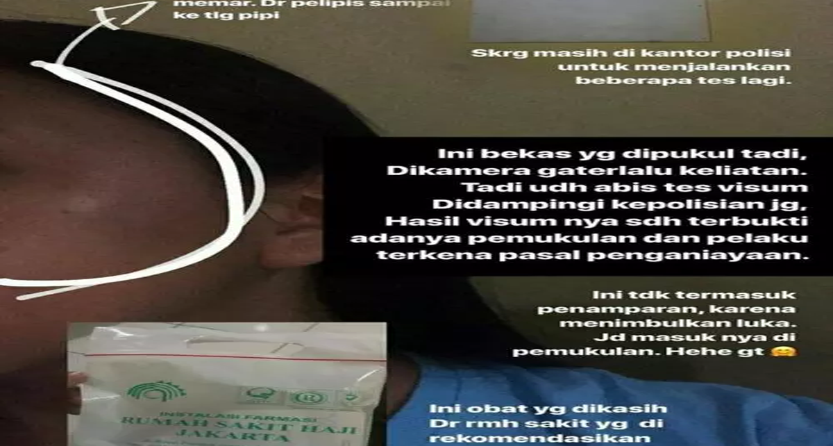 Viral Sopir Blue Bird Aniaya Pelajar Wanita di Bekasi Gara-Gara Tak Terima Ditegur