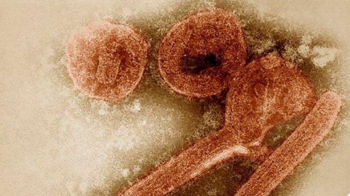Wabah Virus Marburg Yang Sangat Menular Berakhir di Guinea