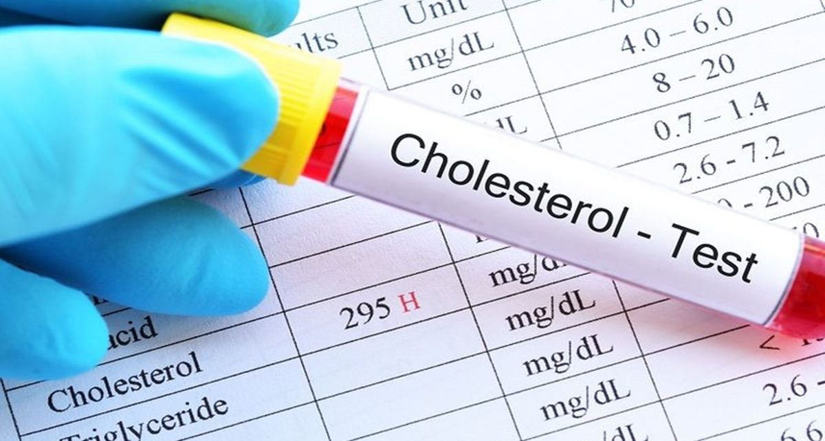 Ternyata Bisa Kurangi Kadar Kolesterol Perlu Kamu Ketahui