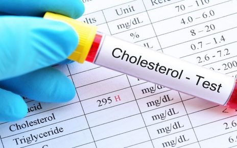 Ternyata Bisa Kurangi Kadar Kolesterol Perlu Kamu Ketahui